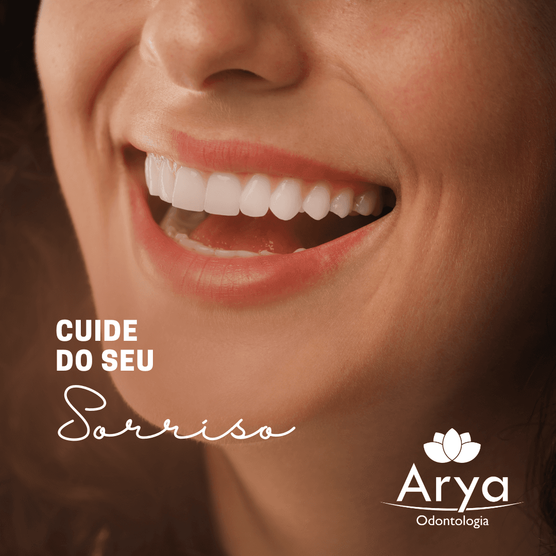 Solução com alinhadores invisíveis — sorriso transformado